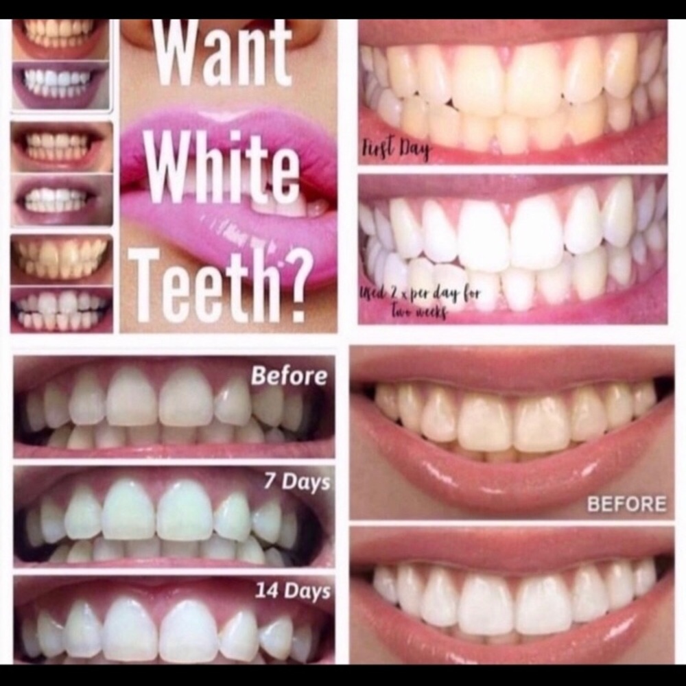 AP24 whitening toothpaste